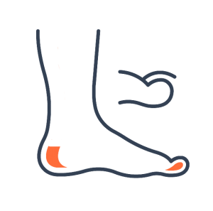 Foot problems