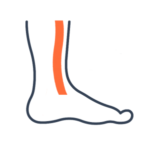 Shin Splints and pain