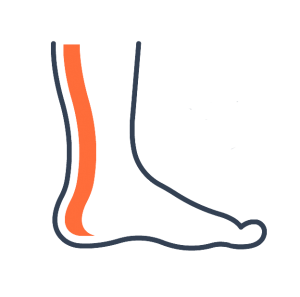 Achilles heel tendinopathy